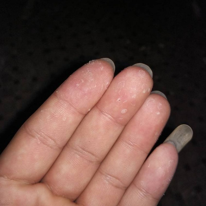 摸摸恢复手脱皮脚底n脱皮专用手季节性手掌指头蜕皮膏脚后跟修复
