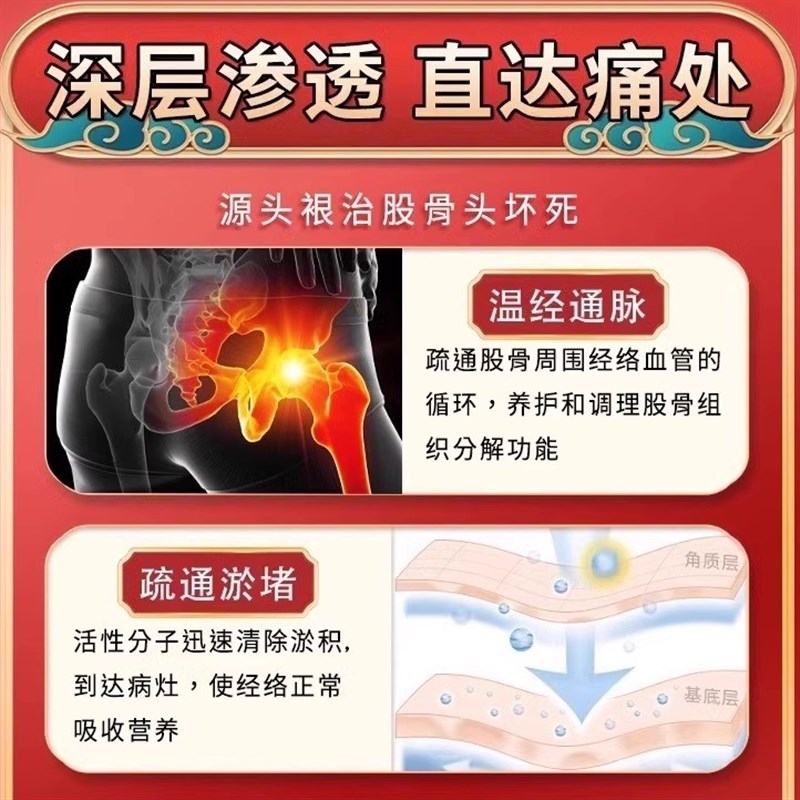 【坏死修复】股骨头坏塌陷跛行缺血无菌性髋关节胯部胯骨疼痛膏贴
