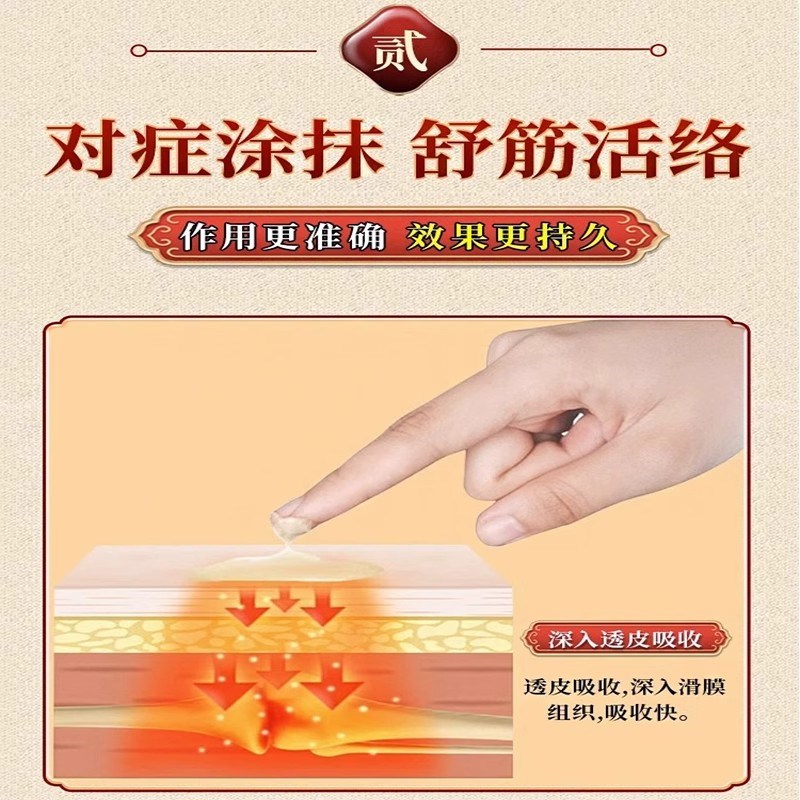 膝盖后窝肿痛药膏腘窝囊肿下蹲困难膝盖不敢打弯小腿肚子酸胀疼痛