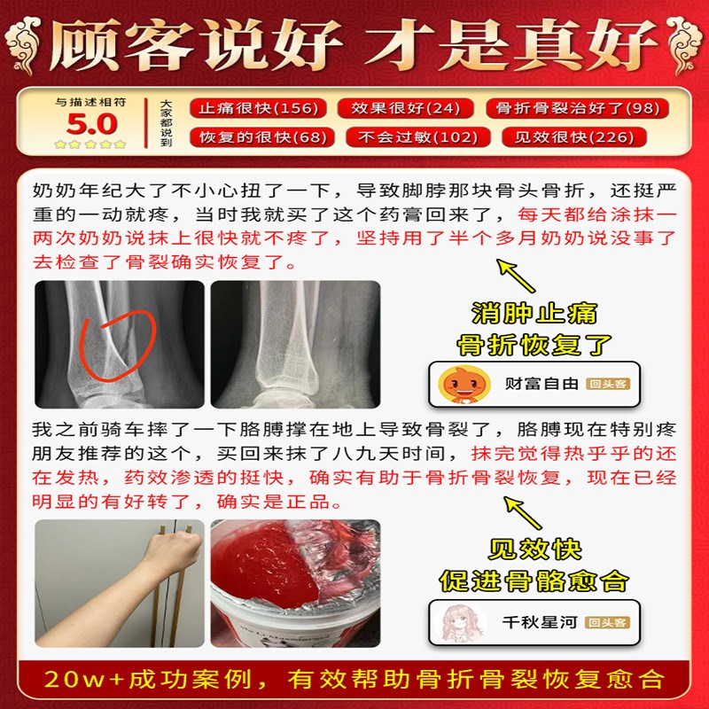 骨折骨裂恢复药快速接骨续筋膏陈旧老伤跌打损伤活血化瘀德国马膏