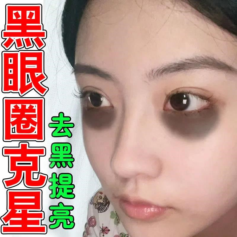 去眼袋黑眼圈神器熬夜黑纹淡化熊猫眼蒸汽眼罩