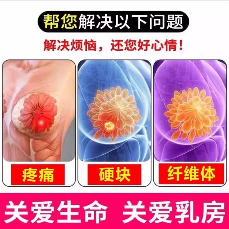 乳腺膏散结膏疏通乳房康小叶结曾生硬块贴疼痛肿胀节积奶副乳堵塞