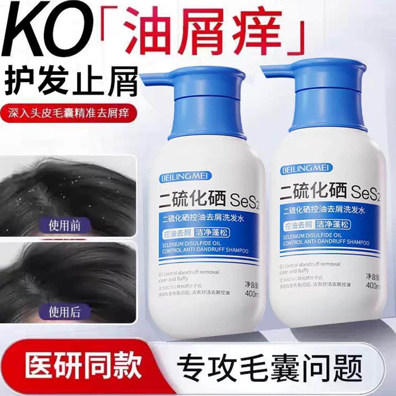 二硫化硒毛囊洗发水去止屑痒炎控油蓬松清洁洗头液旗正品旗舰店