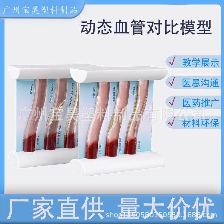 血管模型动态高血脂血管堵塞模型病理性浓稠血管对比解说模型