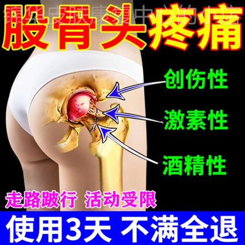 股骨头两边坏死专用药膏贴骶髂关节缺血双髋关节发炎疼痛跛行塌陷