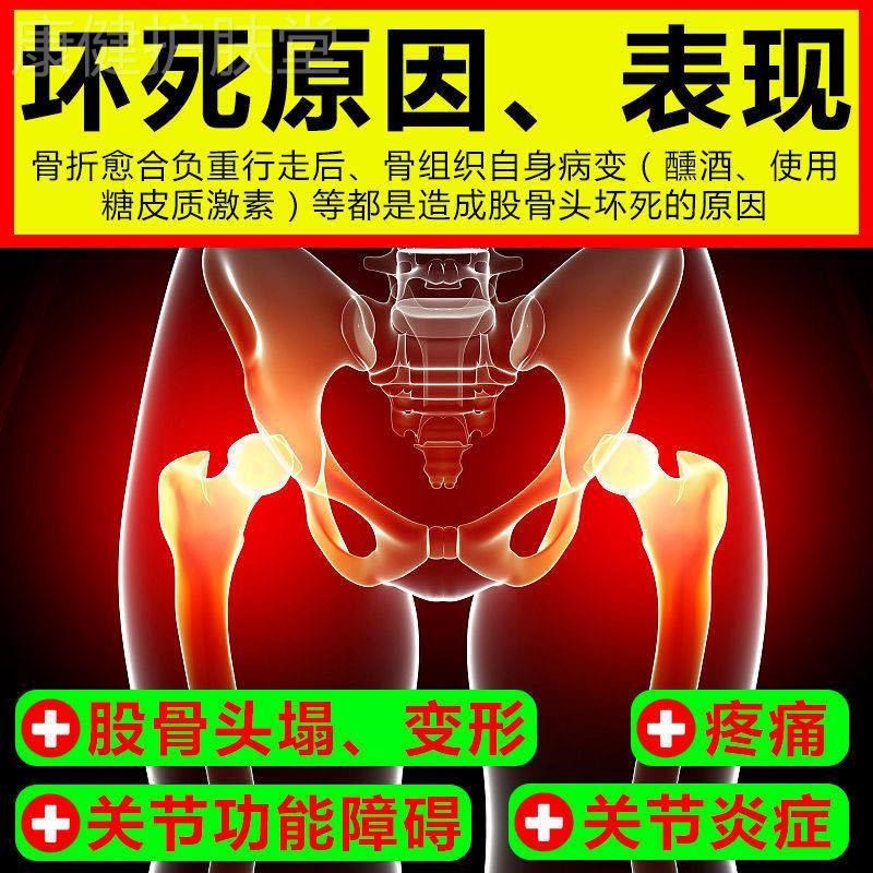 髋关节股骨头疼痛贴大腿屁股疼尾椎疼髋关节发炎疼痛跛行塌陷贴膏
