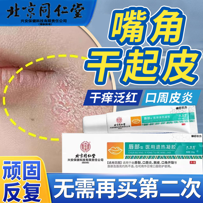 嘴角干燥起皮口周皮炎药膏角炎烂嘴角专脂溢性唇周面部嘴巴周围FZ