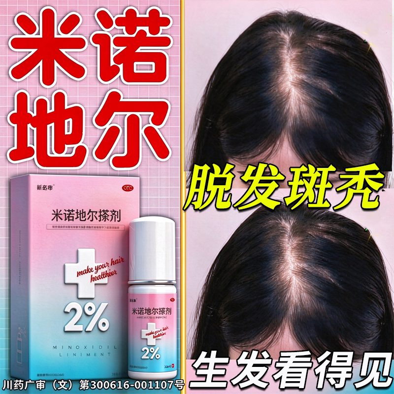 [斯必申]米诺地尔搽剂2%*30ml*1瓶/盒