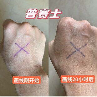 放疗定位记号笔皮肤划线标记着色持久防水不晕染可水洗普赛士