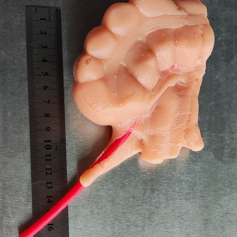 外科腹腔镜阑尾切除3D模型模块