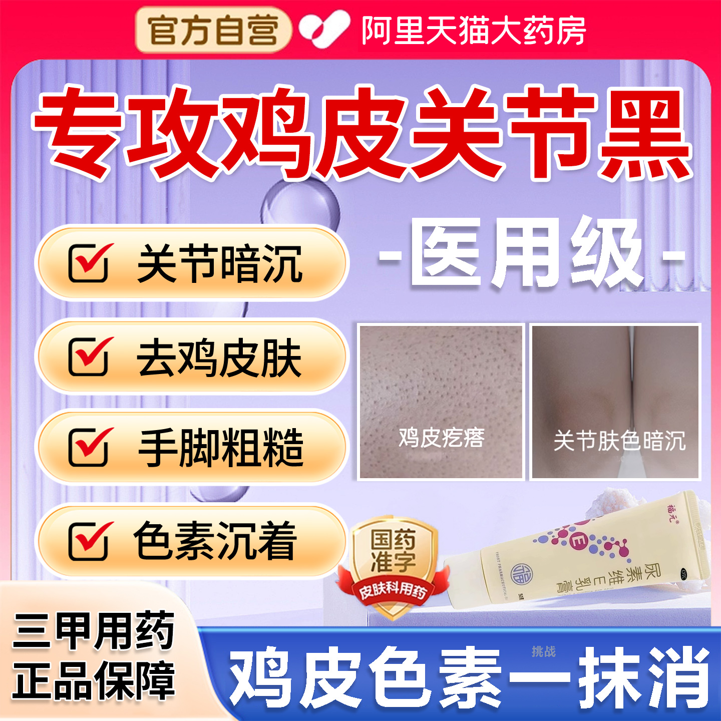 尿素维e乳软膏去鸡皮肤疙瘩淡化黑色素沉淀腋下黑关节专用药膏YD