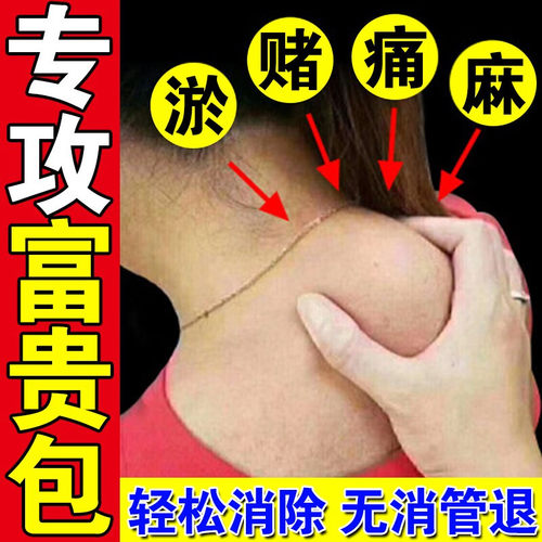 【泰国秘方正品】已售100万+富贵消除包针对脖子劲椎鼓包疼痛