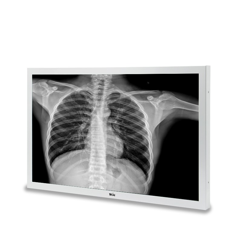 T系列27寸4K医用显示器,支援3840X2160解析度,多接口选择