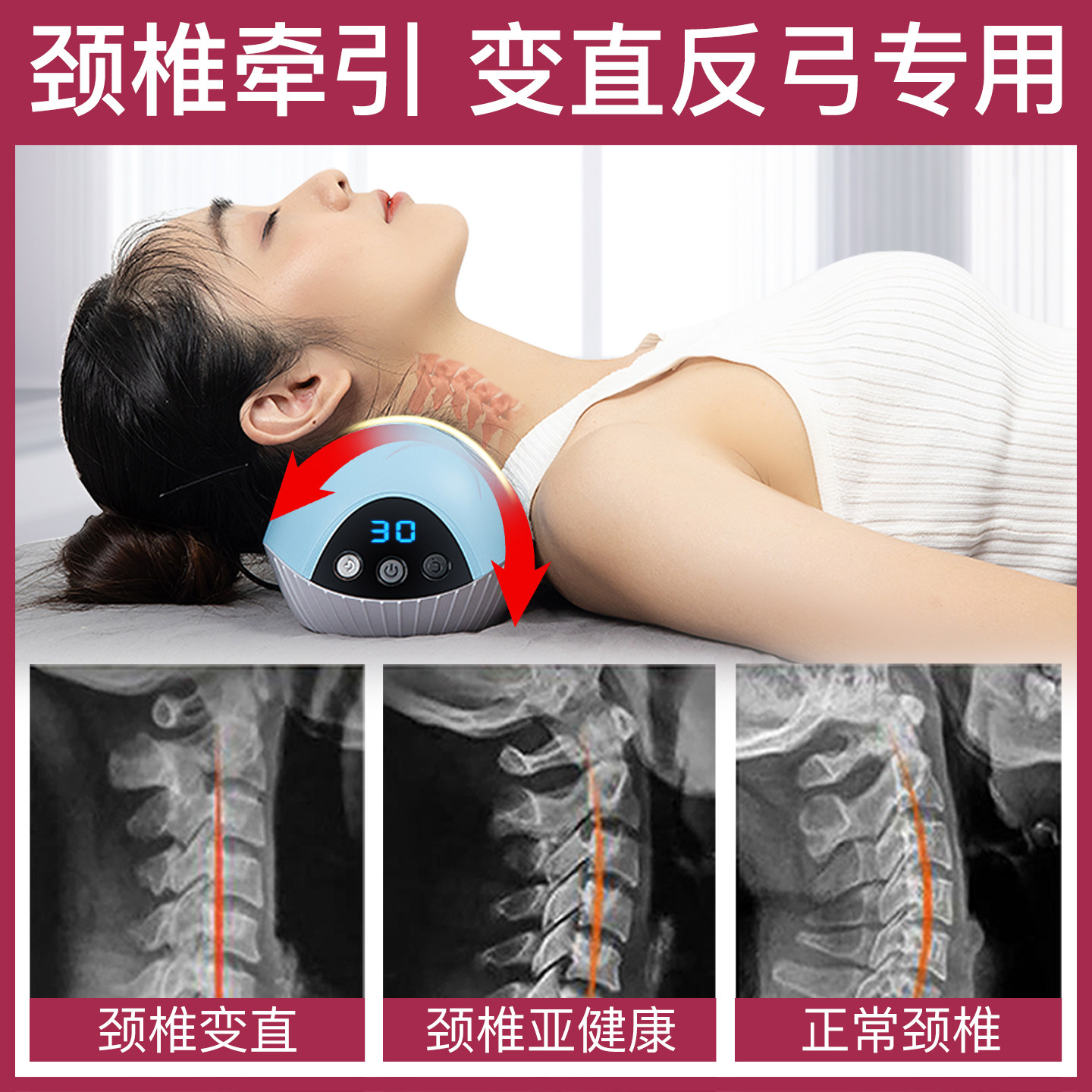颈椎生理曲度变直专用枕头脊椎反弓护颈枕加热拉伸牵引器尚颈元枕