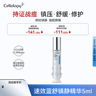 速效蓝舒镇静精华祛痘舒缓暗疮敏感肌修护专用5ml*1支
