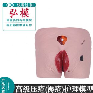 高级压疮(褥疮)护理模型老年人褥疮压疮护理模型医学用教学模型