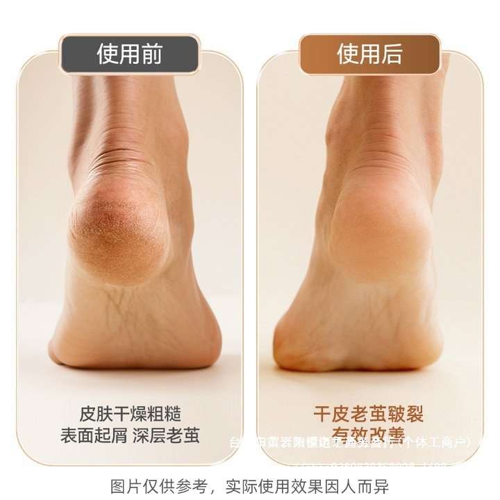 2024新款电动磨脚器电动修脚器家用去死皮脚皮老茧美肤磨其他
