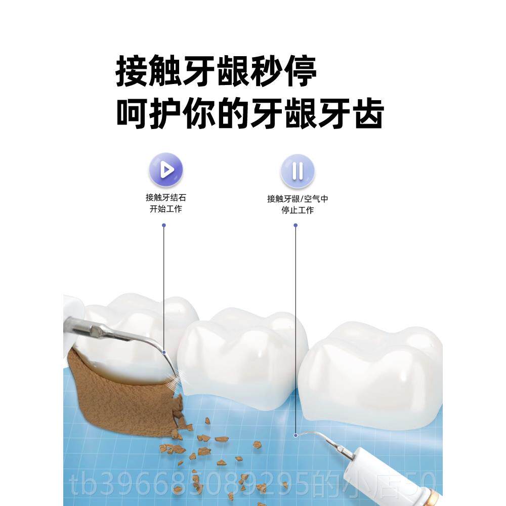 高档牙趣健洁牙器超声波牙洁牙器去除石牙垢乐冲牙器家用洗牙器齿