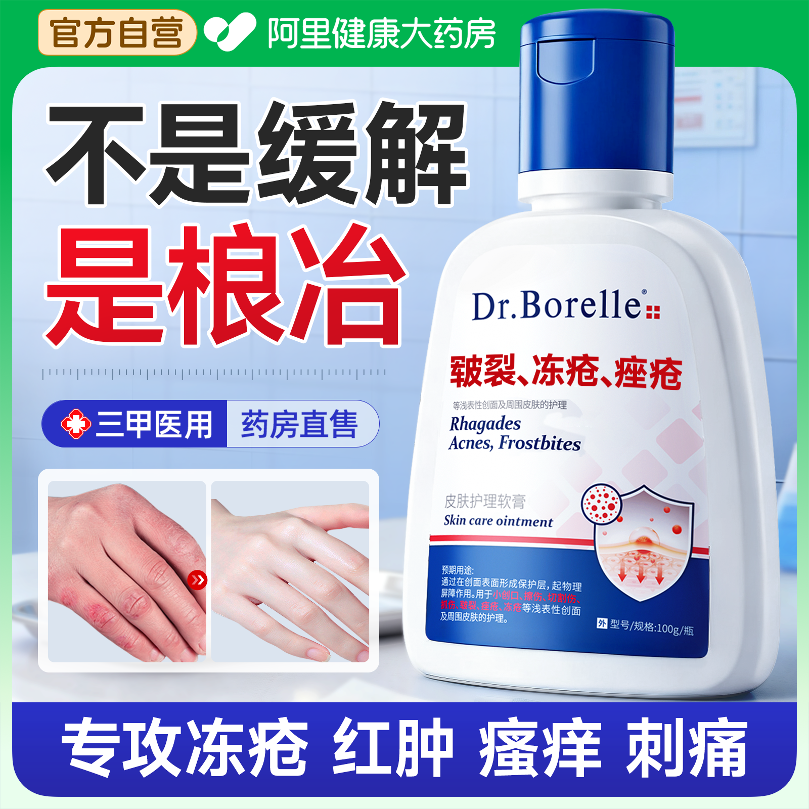 医用冻疮膏止痒冻伤膏儿童耳朵消肿防冻防干裂特正品效护手足面霜