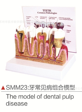 SMM23牙常见病组合模型