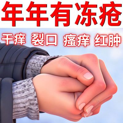 冻疮膏止痒冻伤膏正品官方旗舰店成人儿童脸耳朵手足裂消肿药膏pt