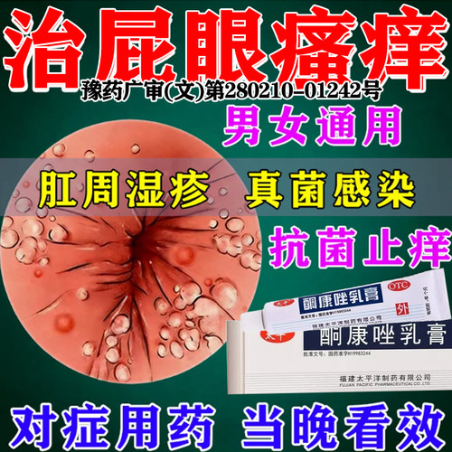 酮康唑乳软膏正品肛门瘙痒药肛周止痒专用去痒潮湿根官方旗舰店XY