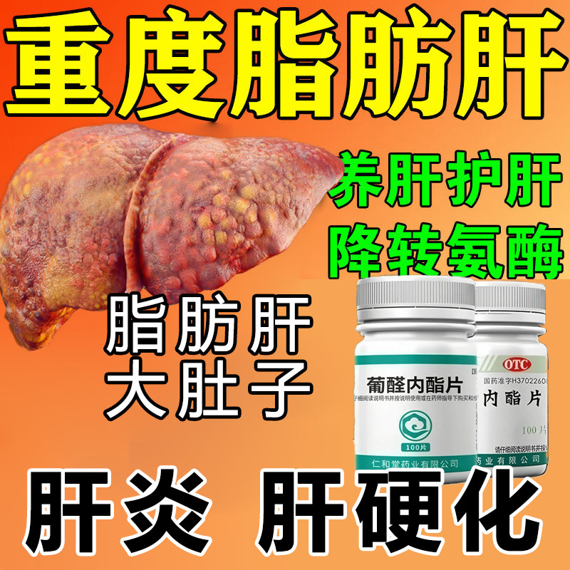 治脂肪肝的药养肝护肝排除肝脏脂肪肝病肝炎酒精葡醛内酯片XY