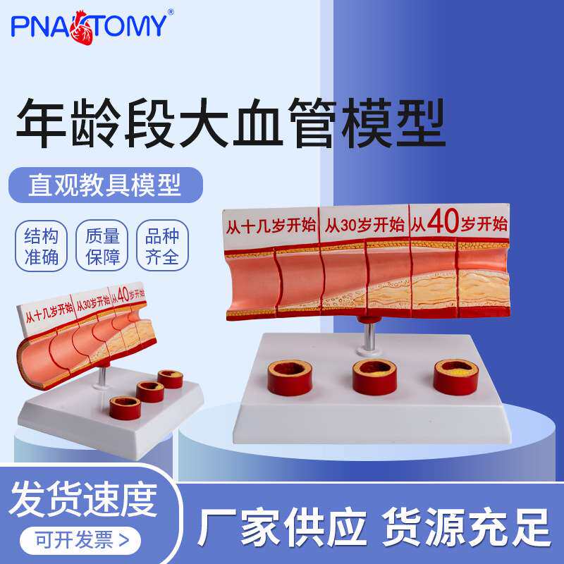 年龄段大血管模型 4部件 /硬化心血管动脉/ 硬化模型血管病理模型