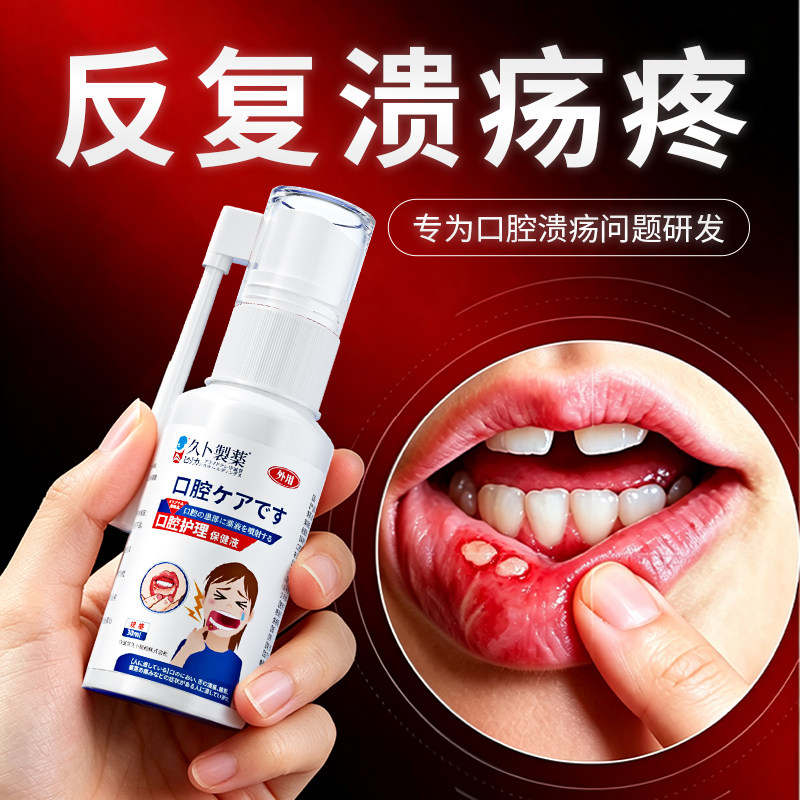 久卜制药口腔溃疡喷雾剂舌头溃疡上火起泡口疮牙龈肿痛溃烂