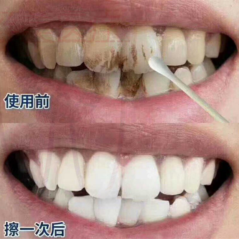 美白牙齿一擦白速效去黄牙烟牙菌斑牙垢黑渍洗牙粉液膏树脂牙斑净
