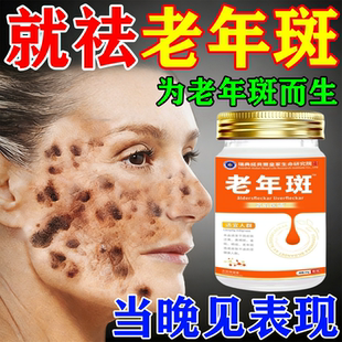 祛斑霜祛黄褐斑老年斑强力去除手部脸部官方旗舰店正品第一名老年