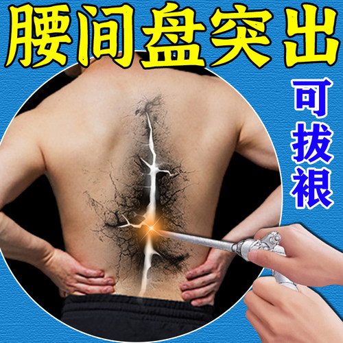 可冶愈】腰疼克星腰突腰脱压迫神经腿麻酸胀屁股疼麻木腰椎贴膏