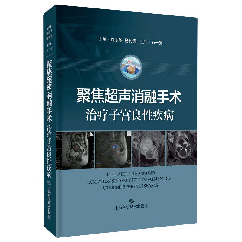 聚焦超声消融手术治疗子宫良疾病(精)