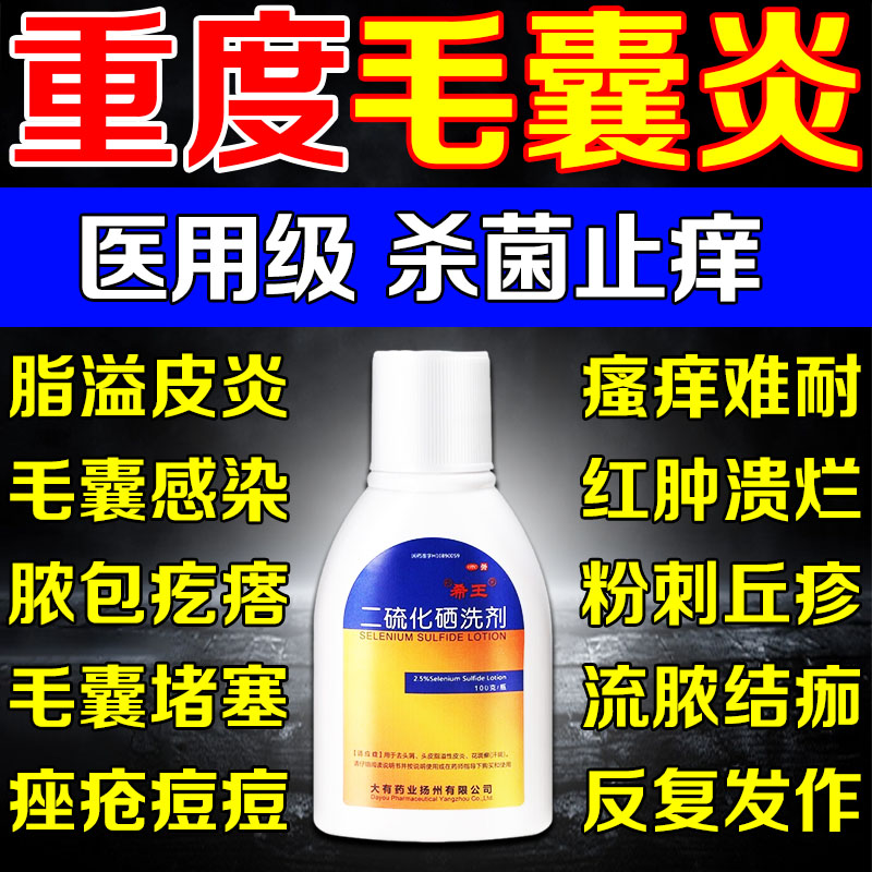 二硫化硒洗发水医用洗剂毛囊炎治疗新效药头部专用发特快头长疙瘩