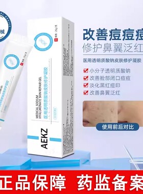 AEKZ修复凝胶小银管vvev凝胶祛痘印闭口透明质酸钠消痘痘修护凝胶
