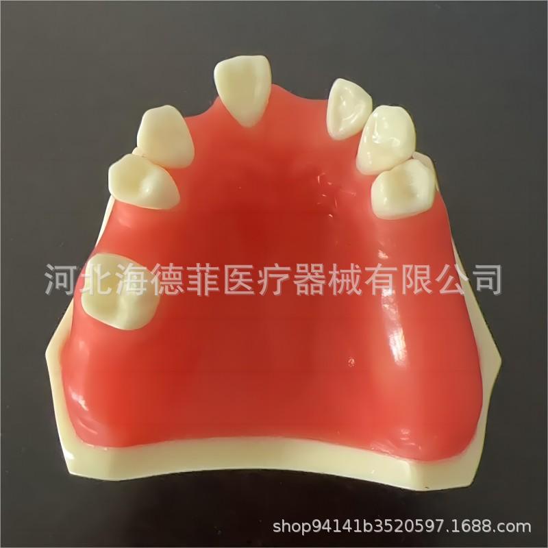种植练习模型 种植牙缺失模型 牙齿种植模型
