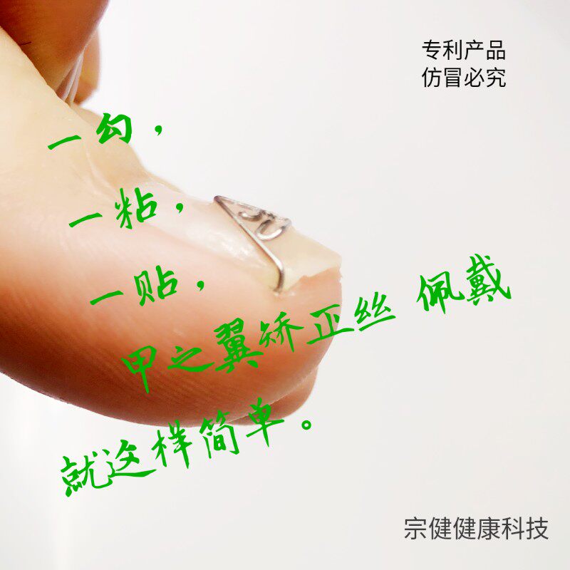宗健嵌甲单侧矫正丝器 矫形片 拇指小趾2345指甲扎肉卷曲变形甲沟