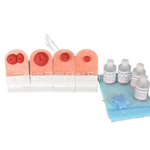教学模型摆桌款造瘘模型瘘管造口护理模型造瘘练习模型
