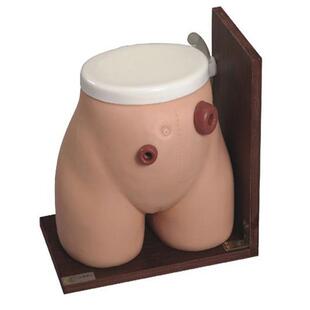 高级瘘管造口护理模型