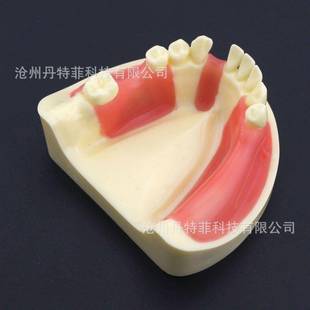 种植缺失模型颌窦模型下牙种植练习模型