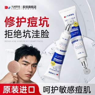 痘坑凹洞修复生长因子祛痘印痘坑痘疤修复淡化黑色素沉淀去除男生