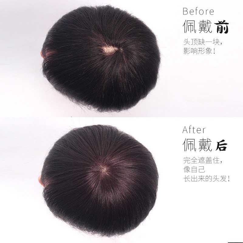 假发片头顶补发片女真发遮白发补发块头顶头发稀少女递针无痕补发