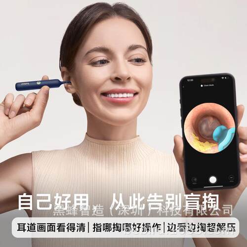 无线3P可能专业工具视耳发光仪器采耳工具耳勺可视化勺套装挖智耳
