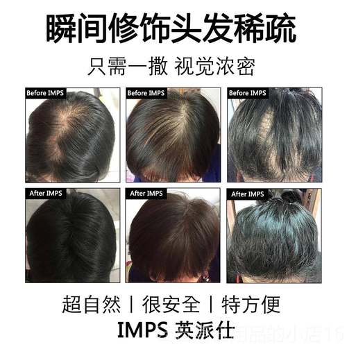 高档IMPS发际线 线填充浓密增多美发发补神器粉密假发增发发头发