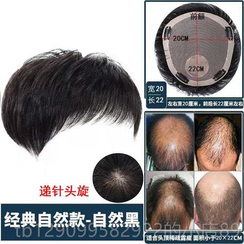 正品假发男短发寸真发无痕隐假发片然男士可自卡形轻薄毛头顶补发
