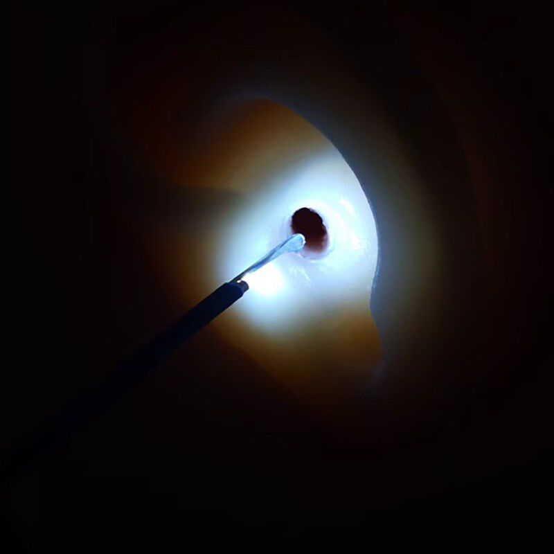 儿童掏耳勺发光夹耳屎镊子硅胶可视耵聍钩充电挖耳朵采耳专业安全