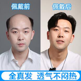 高档单层单根男士假发短帅发气顶秃顶前头额补片男全真假发发隐形