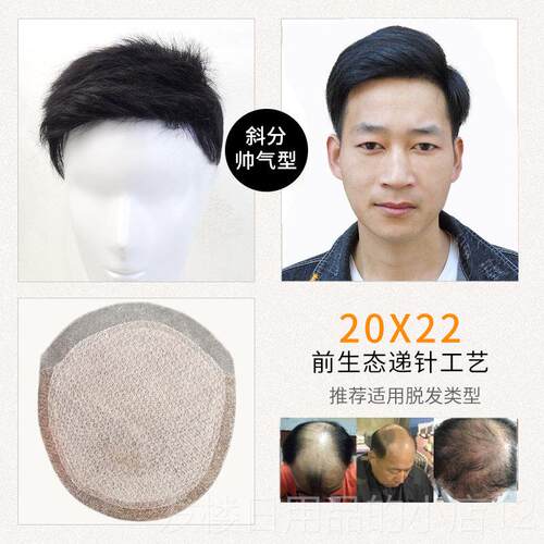 正品男士发形头顶补发男短针真发补发块递前额发假际线隐无痕生物
