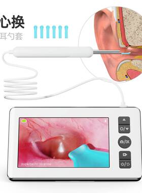 高款屏可视挖耳带勺清可视采耳仪器技BFP新师采耳店专用一体机挖