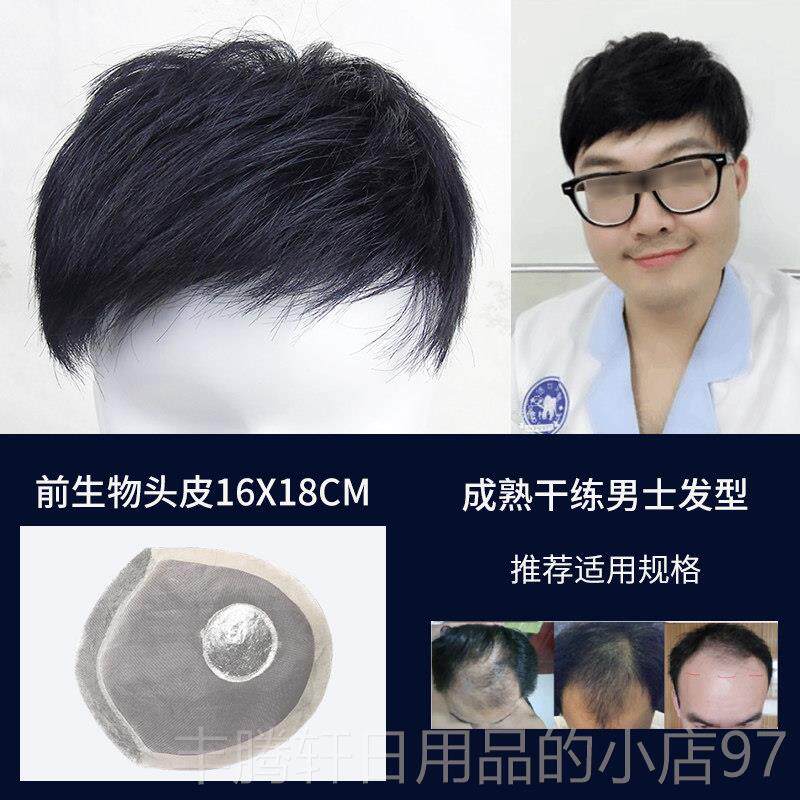 正品男假发头顶补片隐士形痕真发假发片无男短发男式补发发块发片图片